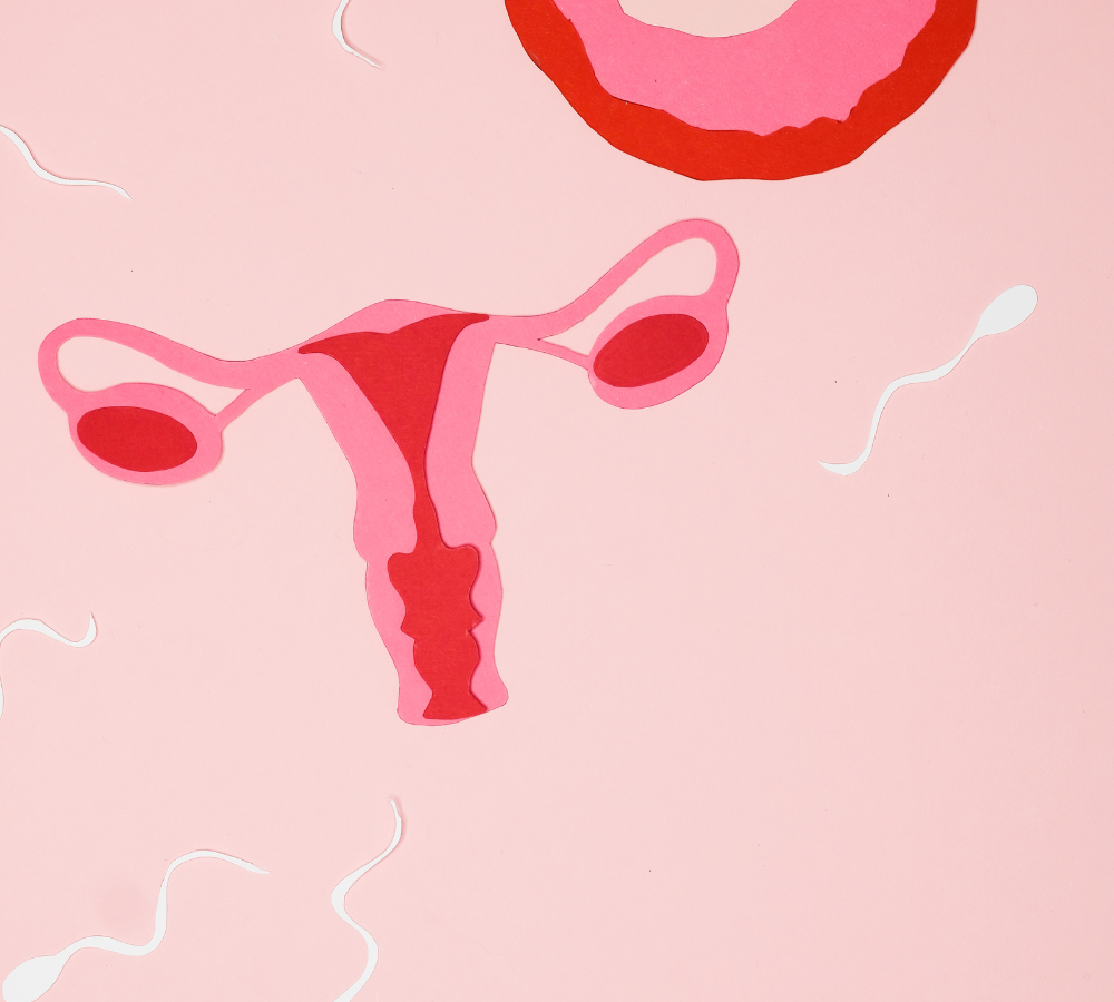 PCOS causes
